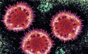 美国新冠病毒疫苗临床试验今天开端招募45名志愿者